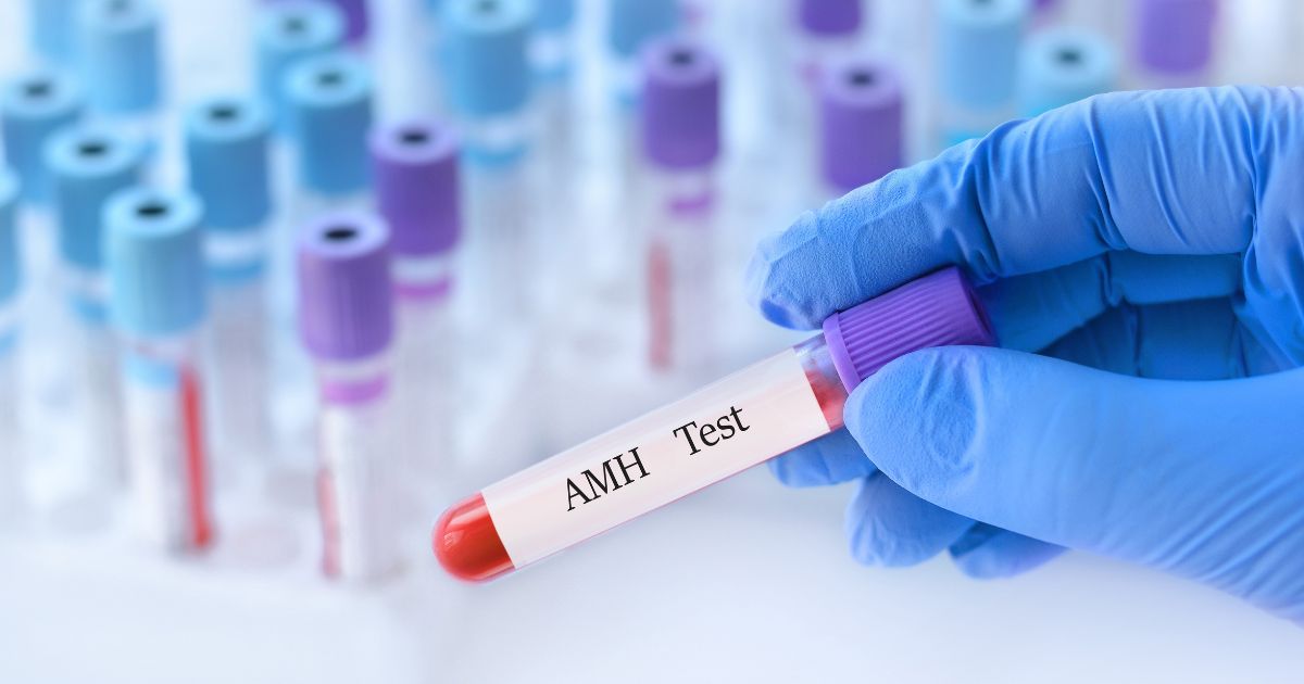 AMH test sa vykonáva z krvnej vzorky a pomáha odhadnúť ovariálnu rezervu ženy.